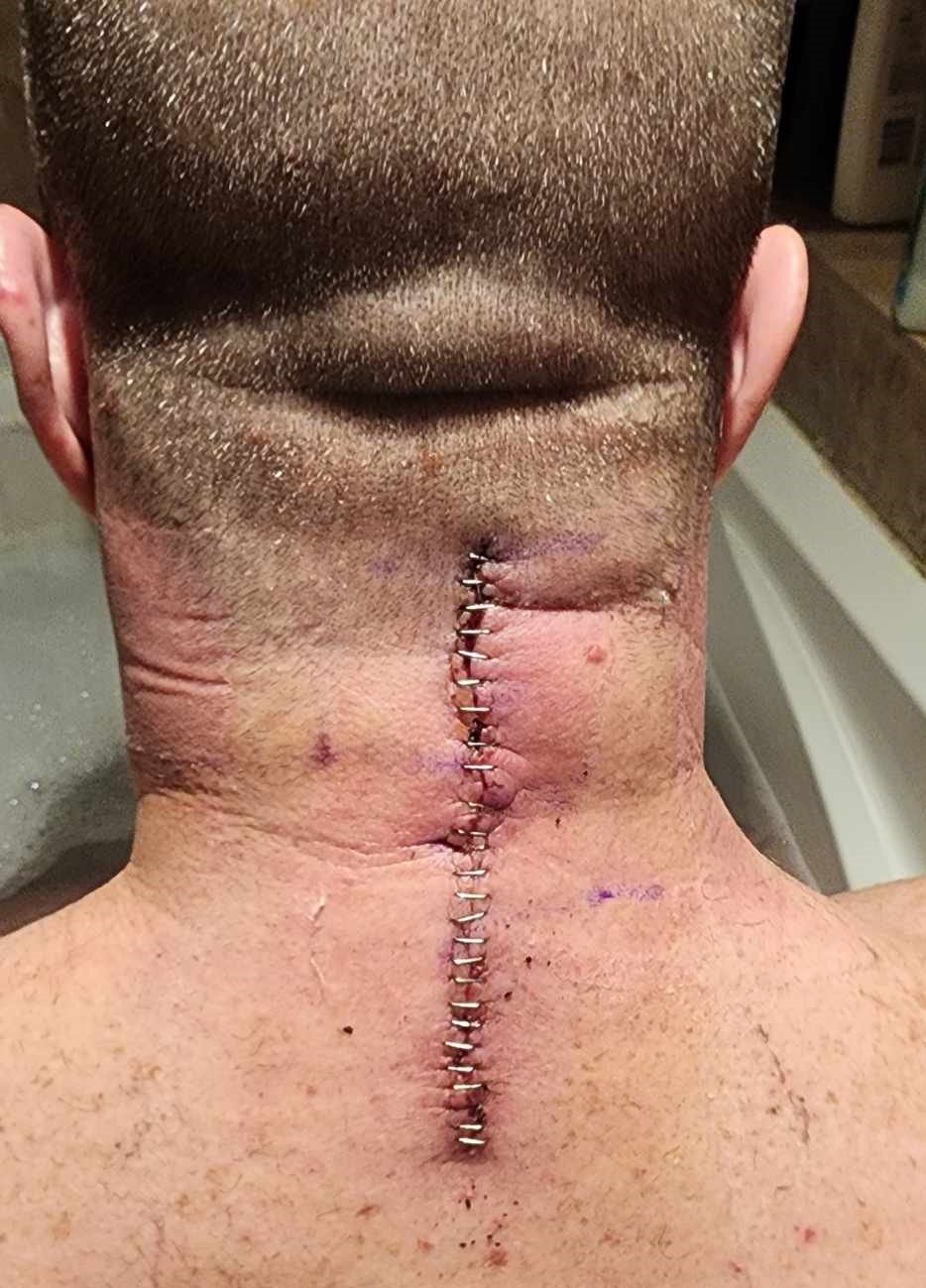 Spiffy’s One Week Post-Broken Neck Official Follow Up
